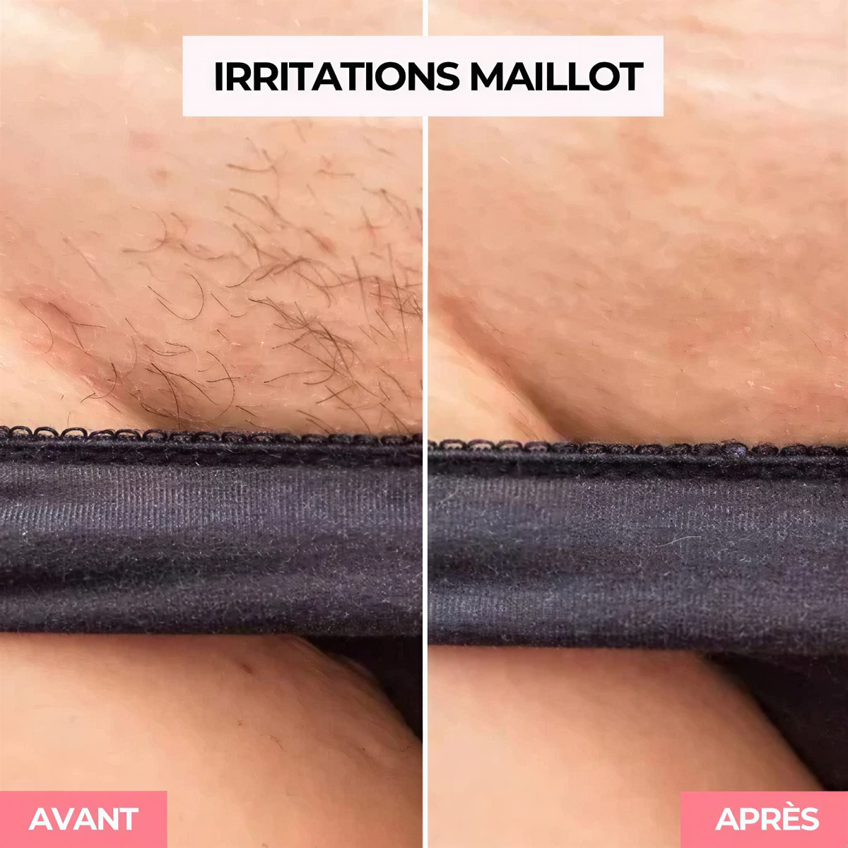 Solendda épilateur à lumière pulsée