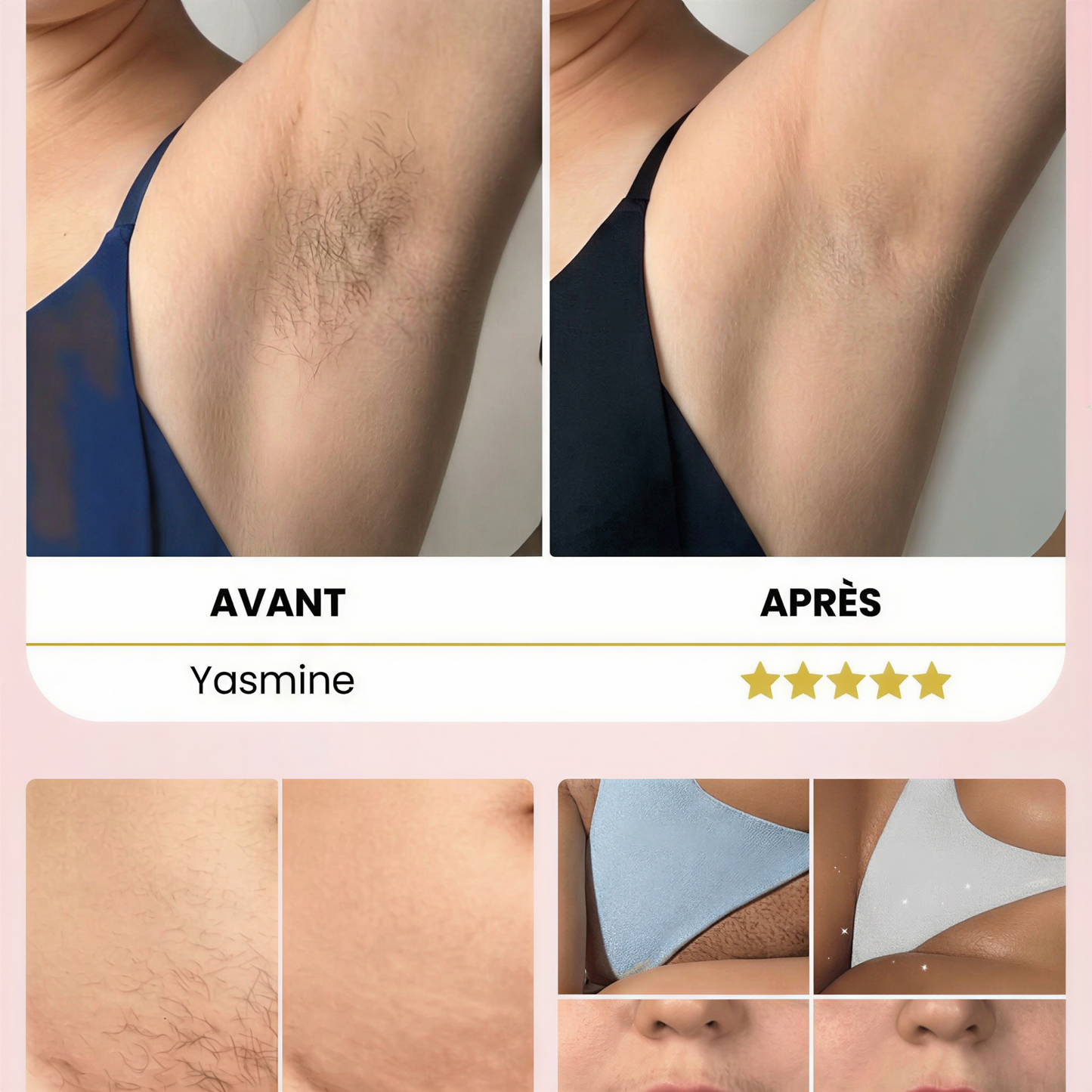 Solendda épilateur à lumière pulsée